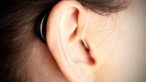 מכשיר שמיעה, (צילום ארכיון: Sonitus Medical / ויקימדיה)