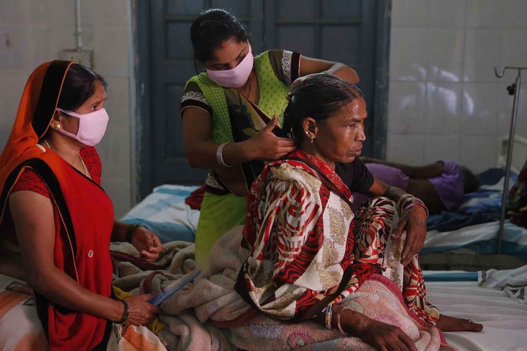 חולה בשחפת מקבלת טיפול בבית חולים בהודו. ארכיון (AP Photo/Rajesh Kumar Singh)