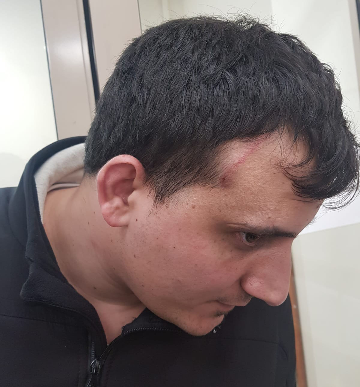 Union chairperson Tal Shitrit with a visible head wound after attempting to enter company headquarters in Petach Tikva (Photograph: Histadrut)