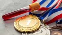 בדיקות סמים בספורט (צילום: Shutterstock)