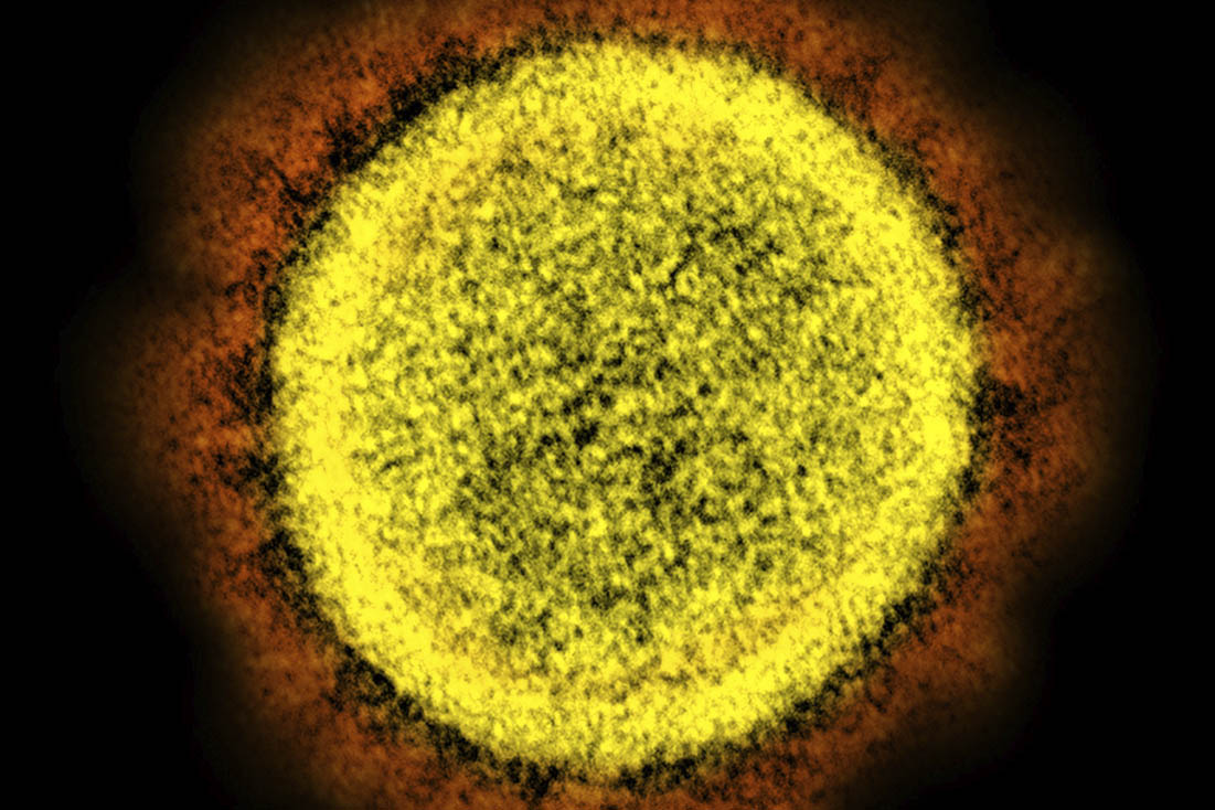 נגיף הקורונה במיקרוסקופ אלקטרוני (צילום: NIAID/NIH via AP)