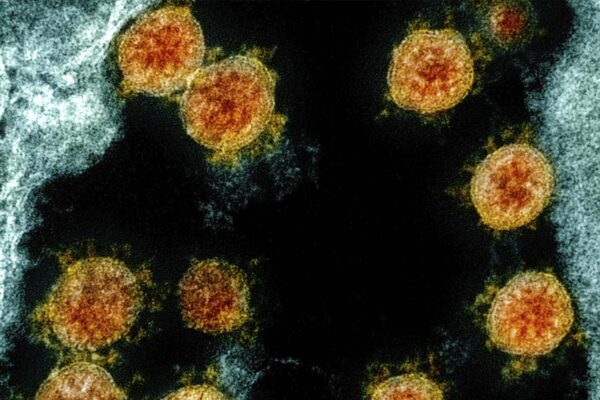 צילום של וירוס הקורונה במיקרוסקופ אלקטרונים. (צילום: NIAID/National Institutes of Health via AP)