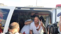 ח''כ עופר כסיף אחרי התקרית. (צילום: הרשימה המשותפת)