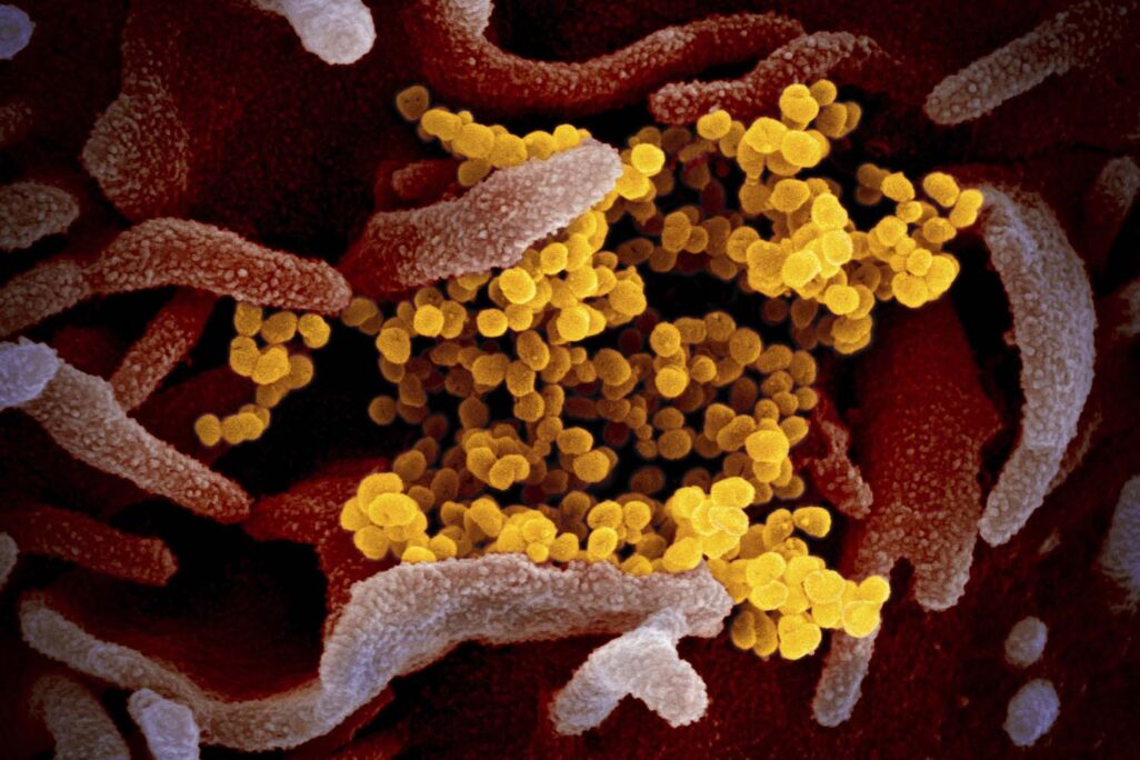 תמונה של נגיפי הקרונה (בצהוב) מגיחים מפני השטח של תאים נגועים, צולמה בעזרת מיקרוסקופ סורק אלקטרונים על ידי המכונים הלאומיים לבריאות בארה&quot;ב. מחקרים אלו כוללים פרוצדורות שעשויות להגביר את פוטנציאל ההדבקה או את חומרת תסמיני המחלה בבני אדם (NIAID-RML via AP)