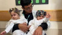 ד"ר מיקי גידון, מנהל נוירוכירורגית ילדים בסורוקה וממובילי הניתוח להפרדת התאומות שנולדו מחוברות (צילום: דוברות בית החולים סורוקה)