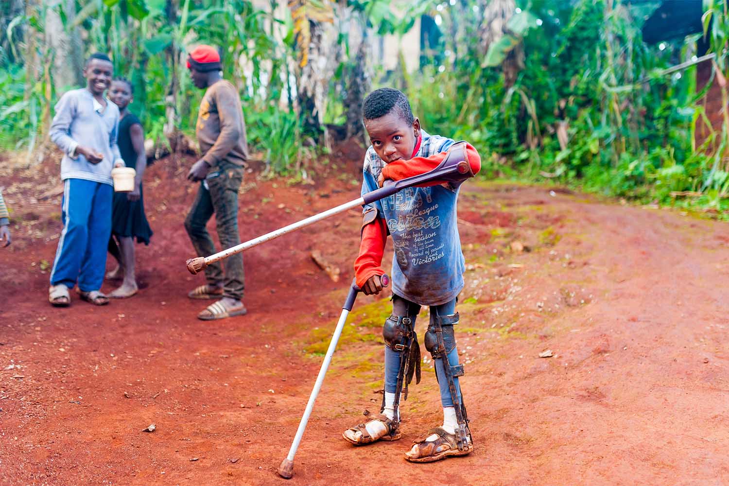 ילד חולה פוליו בקמרון. 564 מקרים באפריקה בשנה החולפת (צילום: davide bonaldo/Shutterstock)
