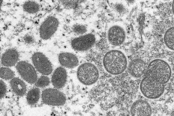 נגיף אבעבועות הקוף, משמאל, בצילום ממיקרוסקופ אלקטרונים (צילום: Cynthia S. Goldsmith, Russell Regner/CDC via AP)