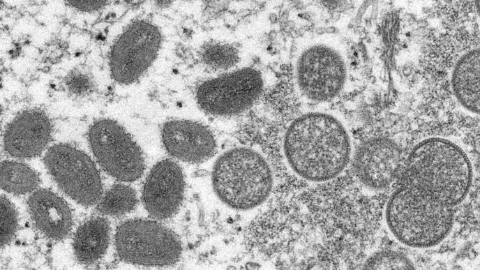 נגיף אבעבועות הקוף, משמאל, בצילום ממיקרוסקופ אלקטרונים (צילום: Cynthia S. Goldsmith, Russell Regner/CDC via AP)