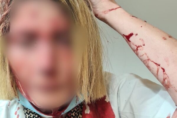 הרופאה שהותקפה על ידי מטופל בסניף קופת חולים כללית בבאר יעקב (צילום: ללא קרדיט)