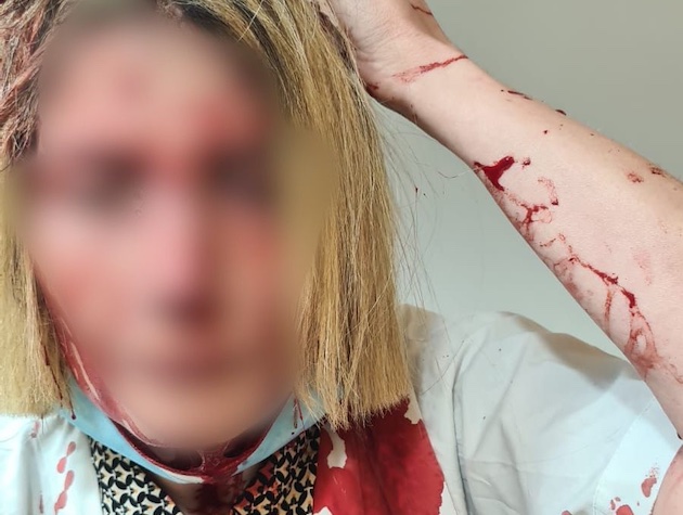 הרופאה שהותקפה על ידי מטופל בסניף קופת חולים כללית בבאר יעקב (צילום: ללא קרדיט)