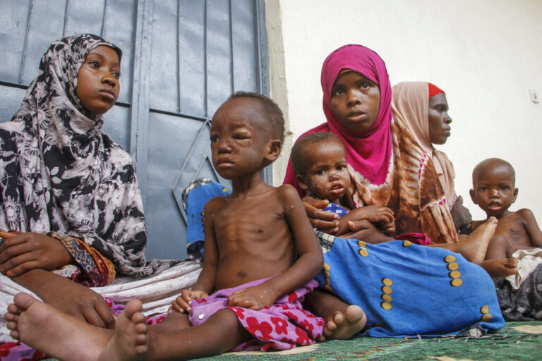 הילדים במחנה העקורים סובלים ממחלות עור שנגרמות מתזונה לקויה. &quot;סומליה היא האחרונה בשרשרת המזון&quot; (צילום: AP Photo/Farah Abdi Warsameh)