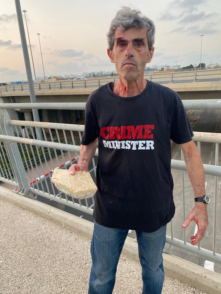 מפגין שהותקף במהלך הפגנה נגד נתניהו במחלף הראשונים (צילום: תנועת קריים מיניסטר)