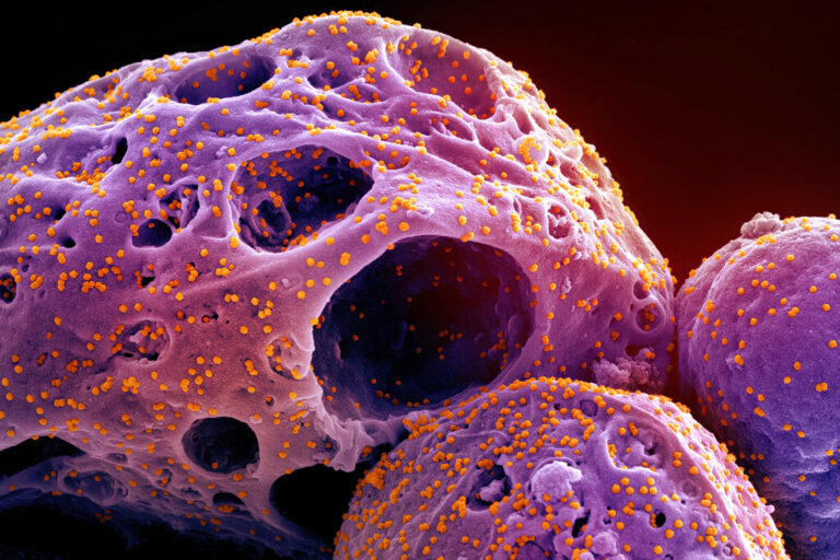 הדמיה של תאים נגועים בזן האומיקרון של נגיף הקורונה, שפרסם המכון הלאומי של ארה&quot;ב לאלרגיה ולמחלות זיהומיות (NIAID/NIH via AP)