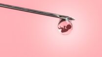 טיפולי פוריות (קרדיט: Shutterstock)