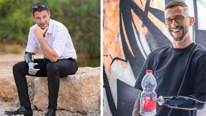 אביחי צפיה (מימין), שידו נקטעה, עם פרוטזת יד קרס שמיוצרת בישראל, ונועם כהן, שידו נקטעה, עם פרוטזת יד ביונים שיוצרה בפילדלפיה (צילום: עמותת 'הצעד הבא')