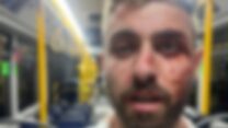 אחמד אלמגרבי, נהג אוטובוס שהותקף בירושלים (צילום: רשתות, ס' 27א)