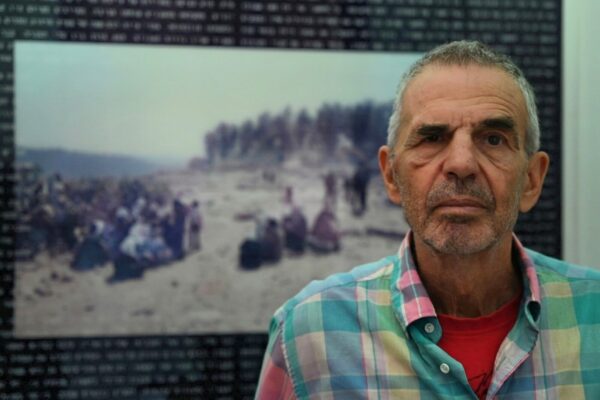 עודד ידעיה, כשבוע לאחר התקיפה (צילום: אור גואטה)