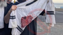 טלית מוכתמת בדם ממתקפת הטרור על יהודים בחוף בונדי בסידני, אוסטרליה (לפ סעיף 27א')